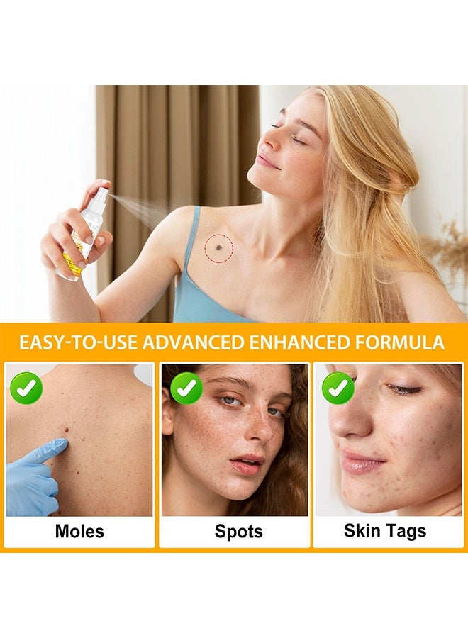 Sefudun Tag Recede Treatment Spray with Bee Venom - Clear Skin Tag and Mole Skin Tag Remover for All Skin Types Tag Recede Bee Venom Spray 60ml  - Image 5