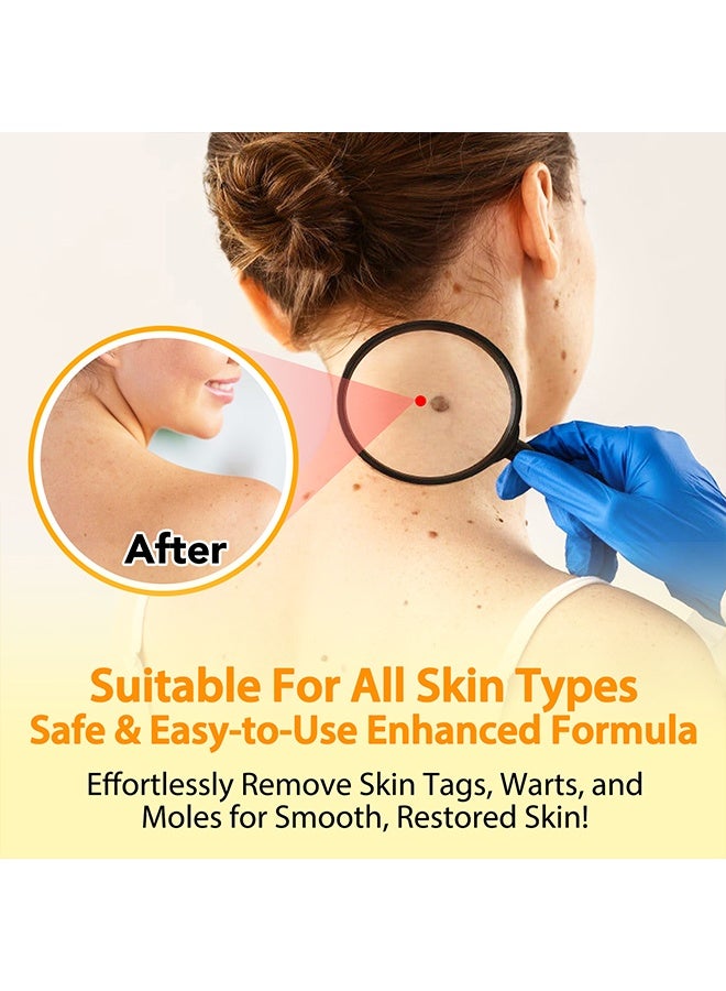 Sefudun Tag Recede Treatment Spray with Bee Venom - Clear Skin Tag and Mole Skin Tag Remover for All Skin Types Tag Recede Bee Venom Spray 60ml  - Image 4