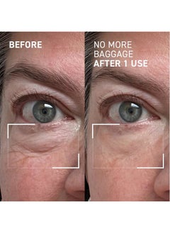 Dr. Brandt Skincare Dr. Brandt Needles No More, No More Baggage - Minimizes Under-Eye Bags, Puffiness & Dark Circles - 0.5 oz  - Image 3