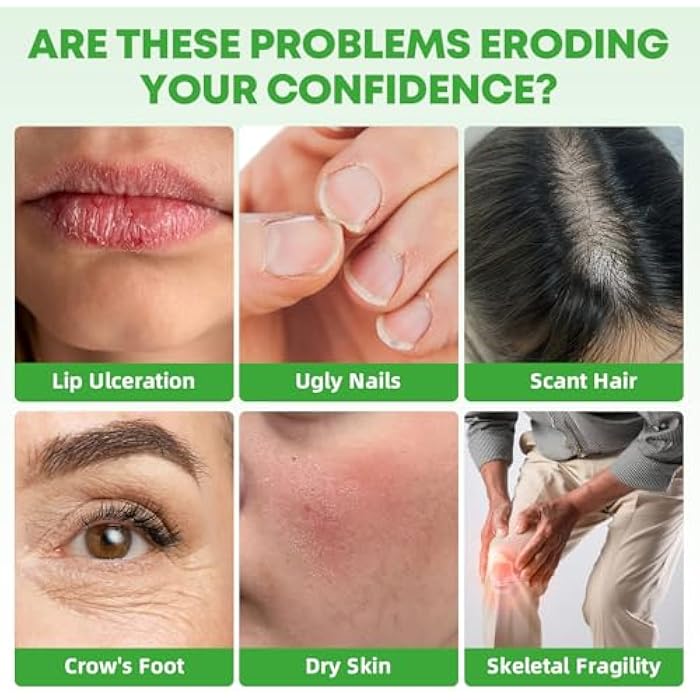 BIYODE L-Lysine Gummies with 1000mg: Lip & Skin Wellness with Vitamin C Zinc CoQ10 Hyaluronic Acid Sugar-Free Vegan Pectin Non-GMO Natural Watermelon Flavor 60 Gummies 30-Day Supply - Image 3