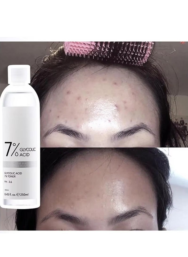 7% Glycolic Acid Toner Refreshing Toner Water Nourish Sooths Skin 250ml