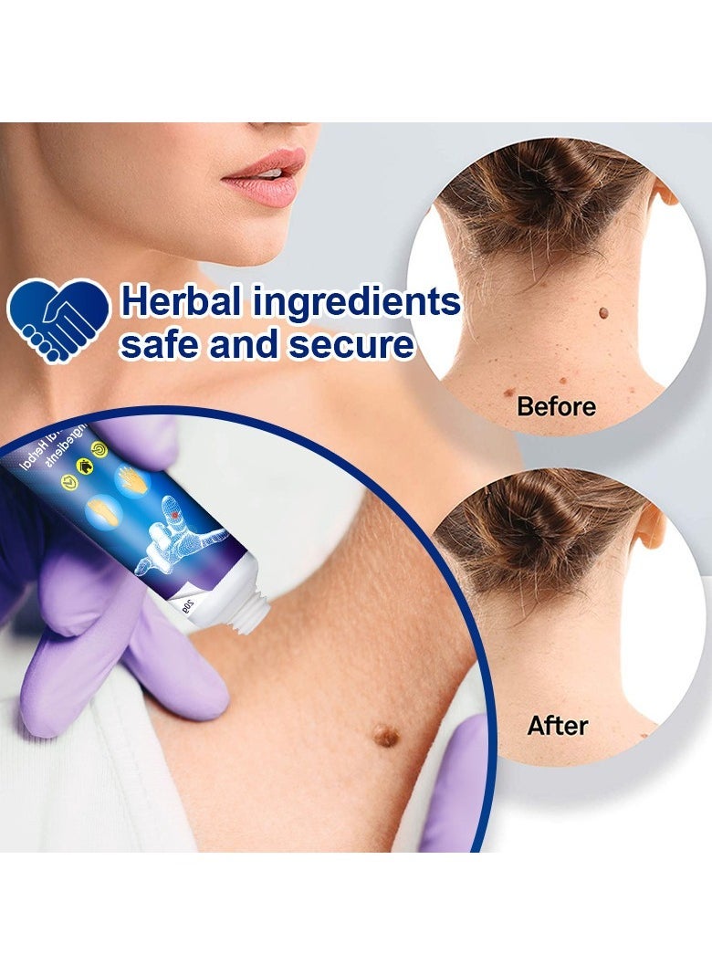 Sumifun 2-PACKS Wart Removal Cream,  Wart Remover for Plantar Warts, Common Warts, Corns, Wart Cream 20g*2 - Image 2