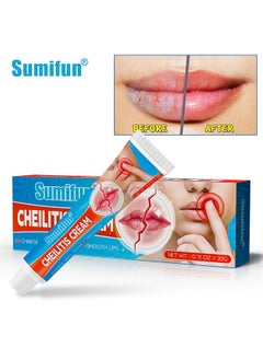 Cheilitis Cream, Healing Lip Balm For Severely Chapped Lips, Natural Ingredients For Instant Cooling and Pain Relief, Dead Skin Removal/Fade Lip Lines/Improve Lip Color