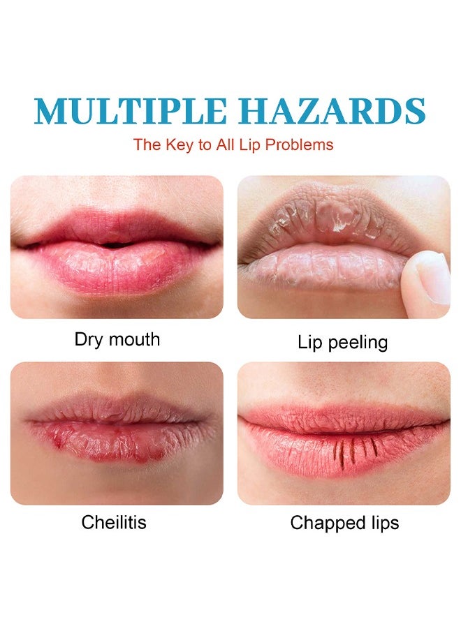 Sumifun - Cheilitis Cream, Healing Lip Balm For Severely Chapped Lips, Natural Ingredients For Instant Cooling and Pain Relief, Dead Skin Removal/Fade Lip Lines/Improve Lip Color - Image 1
