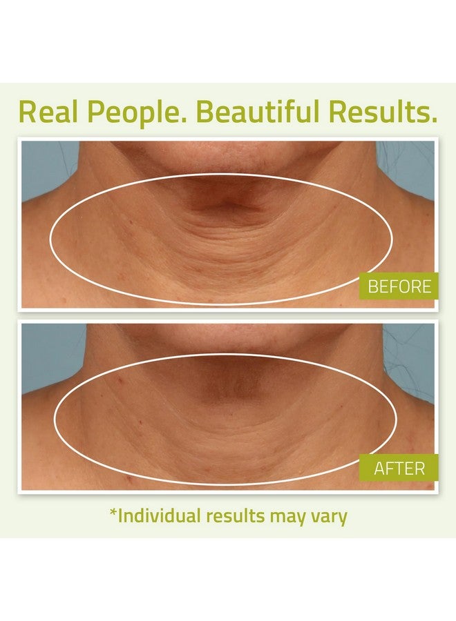 YEOUTH Neck Cream with Vitamin C - Neck Firming Cream for Decolletage and Double Chin - Neck and Chest Firming Cream - Neck Brightening Cream 2oz - Cleavage Moisturizing - Women and Mens Neck Cream - Image 4