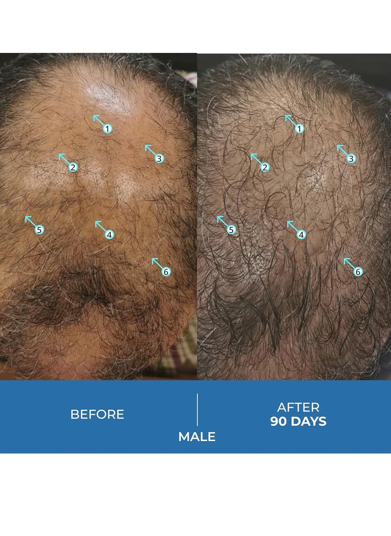 DS LABORATORIES Spectral.UHP | Extra Strength Hair Growth Treatment with Minoxidil 5% (3 Month Supply)  - Image 2