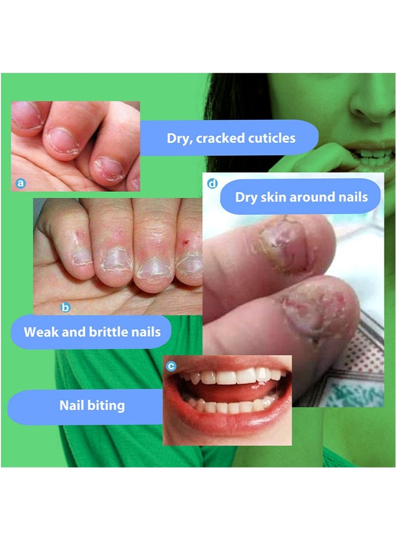 Lanthome Stop Nail Biting Liquid，Nail Biting Treatment for Kids，Natural Thumb Sucking Pain Relief for Kids，Bitters，Plant Extracts （15ml） - Image 2