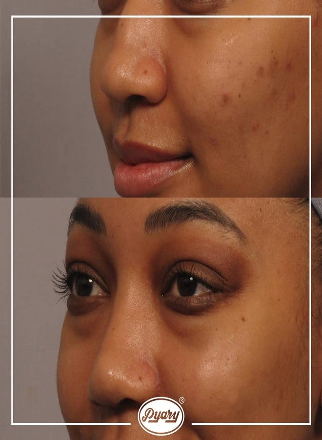 Pyary Turmeric Soap Bar - Skin Illuminating & Dark Spots removal Pack of 2(5.3 Oz)- Face & Body Bliss - Crafted with Naturally Divine Ingredients - Image 2