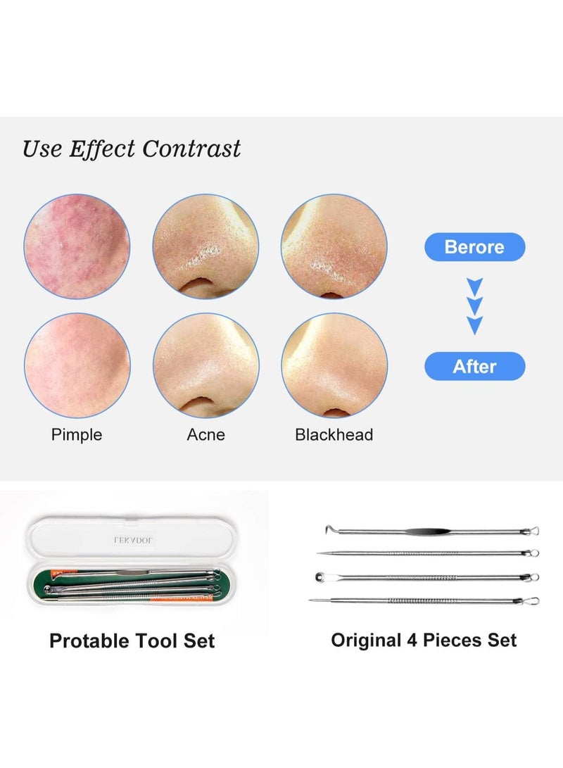 Generic LEKADOL Acne Needle Set Blackhead Pimple Acne Whitehead Removal Needle Kit Acne Treatment Tool, Stainless Steel, 4Pcs, B23001 - Image 5