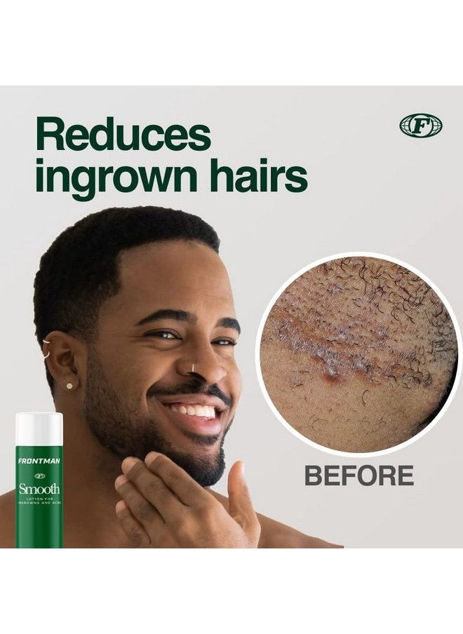 FRONTMAN - Smooth Glycolic Acid Ingrown Hair Treatment & Prevention For Men Razor Bumps And Razor Burn With Aloe Vera - Image 1