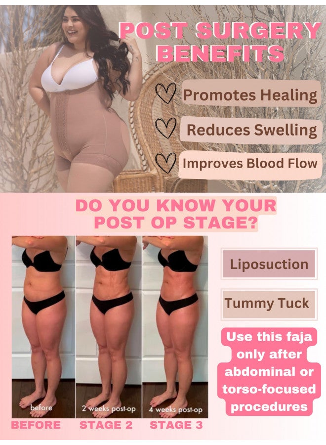 Sonryse S66 Stage 2 Faja Post Surgery Tummy Tuck BBL Lipo Compression Garment for Women Beige S - Image 3