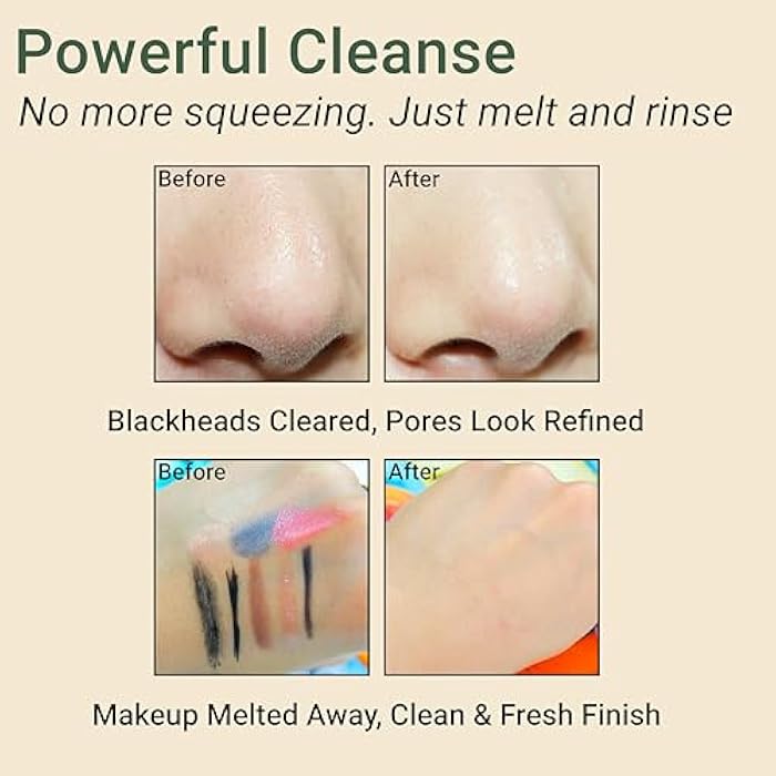 CELDYQUE Pore Purifying Cleansing Oil – Korean Face Wash with Centella, Tea Tree, Green Tea & LHA – Gentle Makeup Remover for Sensitive, Acne-Prone Skin, Deep Pore Cleanser, 6.76 fl oz - Image 5