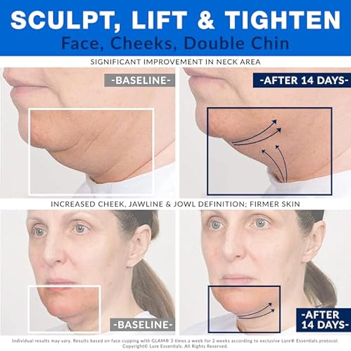 Lure Essentials Glass Facial Suction Cup Size 3 Medium Cup for Facelift Wrinkles Lymphatic Massage - Image 3