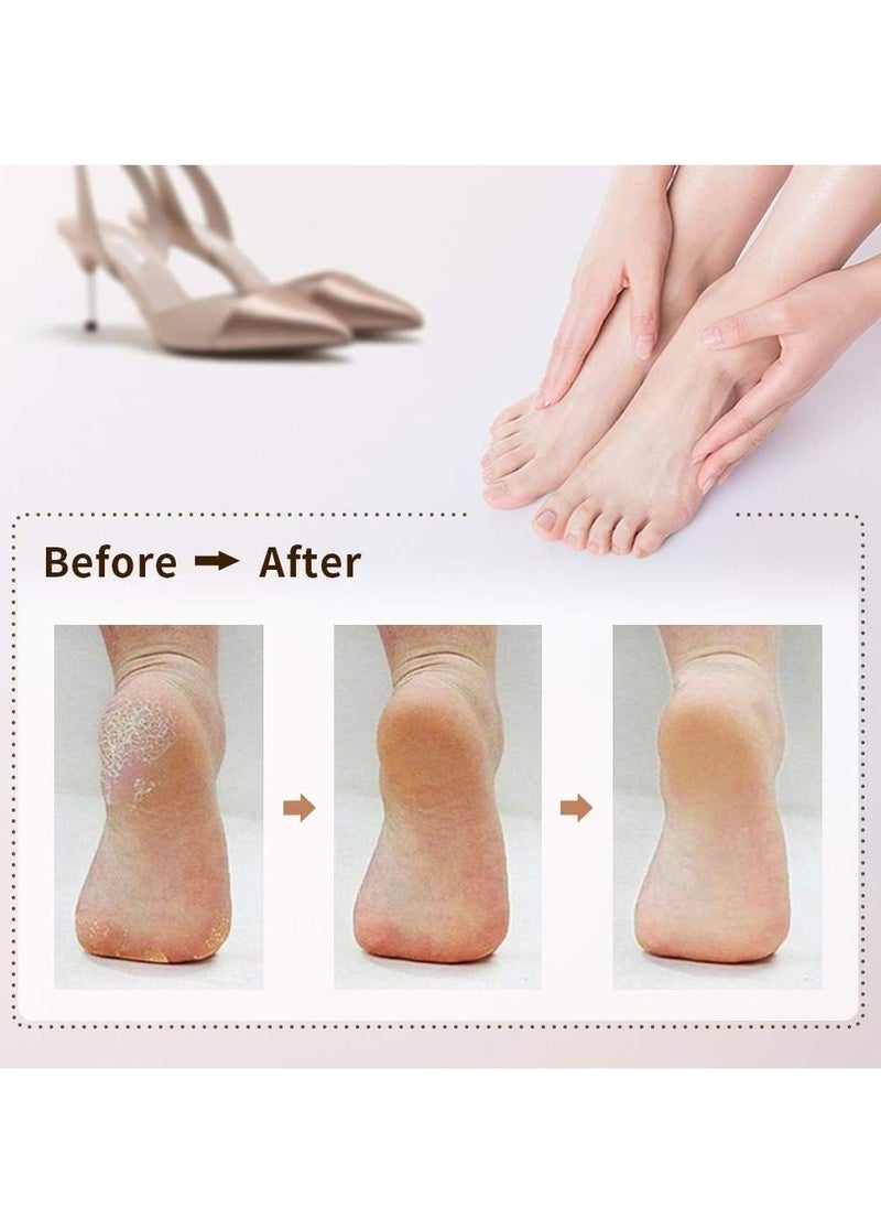 Gonice Rechargeable Electronic Feet File Pedicure Foot File Foot Rasp with IPX7 Waterproof Design for Dry Cracked Dead Skin  - Image 3