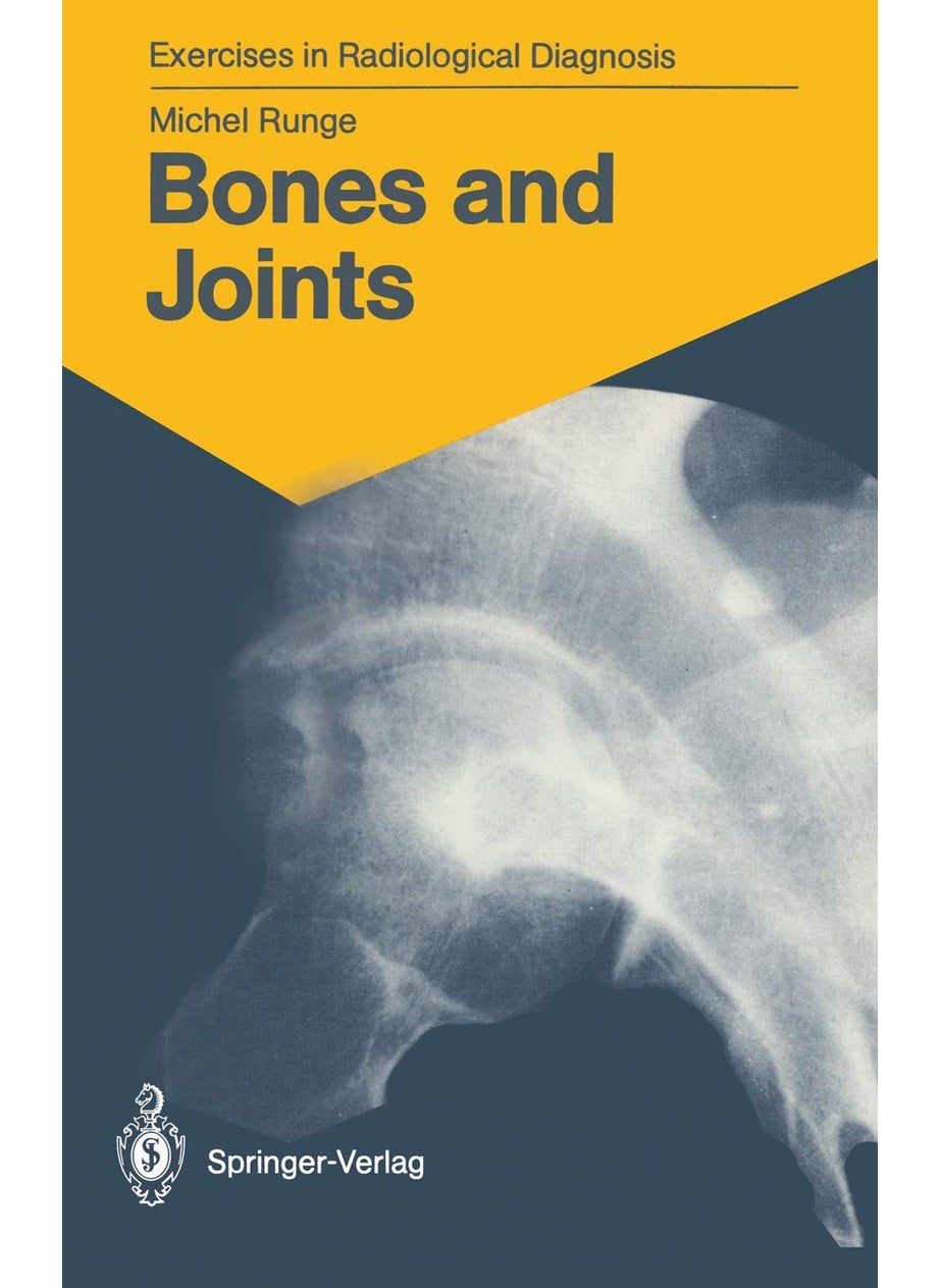 Bones and Joints: 170 Radiological Exercises for Students and Practitioners 