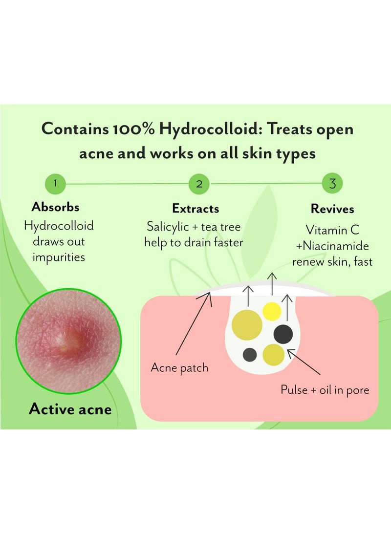 Urban yog Acne Pimple Patch - 72 Invisible Facial Stickers cover with 100% Hydrocolloid (Acne Pimple Patch (Pack of 2)) - Image 4