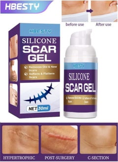 HBESTY Silicone Scar Gel, Scar Cream，Scar Gel，Acne Scar Treatment，Deep Acne Scar Removal， Burns Keloids Hypertrophic， Scar Removal Cream， Repair Damaged Skin，Removing Acne Marks,  Scar Repair Cream  - Image 1