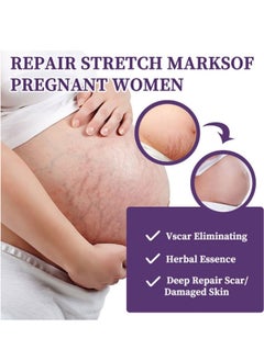 HBESTY Silicone Scar Gel, Scar Cream，Scar Gel，Acne Scar Treatment，Deep Acne Scar Removal， Burns Keloids Hypertrophic， Scar Removal Cream， Repair Damaged Skin，Removing Acne Marks,  Scar Repair Cream  - Image 2