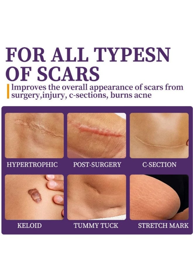 HBESTY Silicone Scar Gel, Scar Cream，Scar Gel，Acne Scar Treatment，Deep Acne Scar Removal， Burns Keloids Hypertrophic， Scar Removal Cream， Repair Damaged Skin，Removing Acne Marks,  Scar Repair Cream  - Image 4