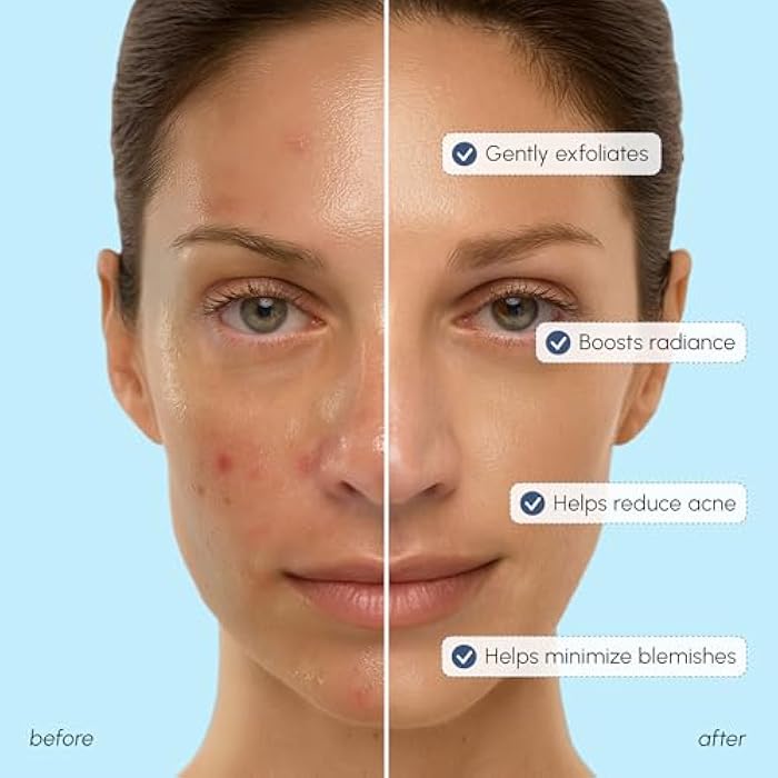MAREE Toner Glycolic Acid Exfoliating Toner for Face Acido Glicolico para Manchas - Image 3