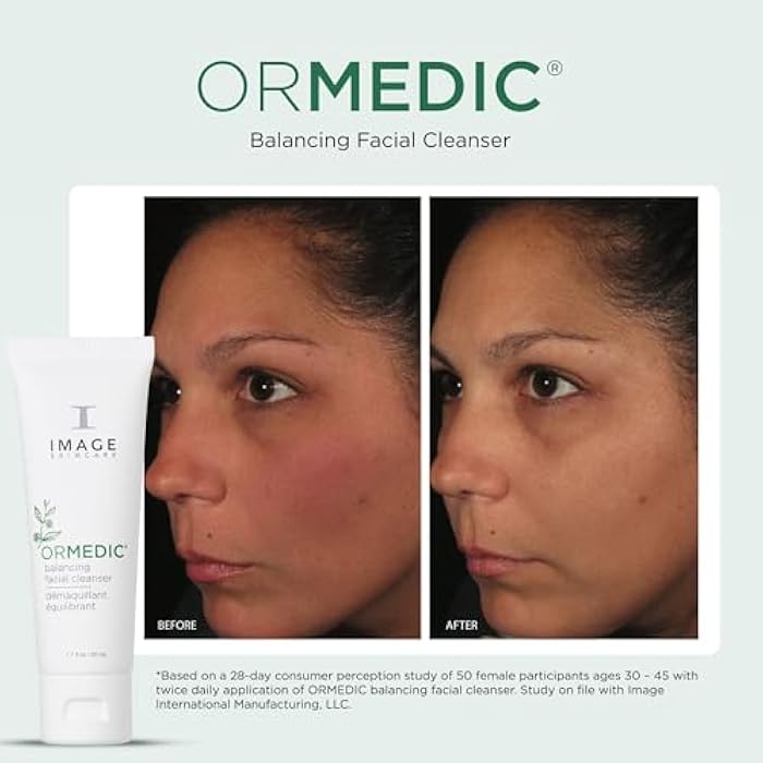IMAGE Skincare, Ormedic pH Balancing Facial Cleanser, Mild Foaming and Hydrating Face Wash with Aloe Vera - Image 4