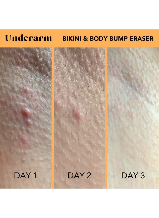 sweetspot labs Bikini & Body Bump Eraser Treat Razor Bumps & Dark Spots With Essential Ingredients Niacinamide & Bentonite Clay Pack Of 2 X 0.5Oz  - Image 4