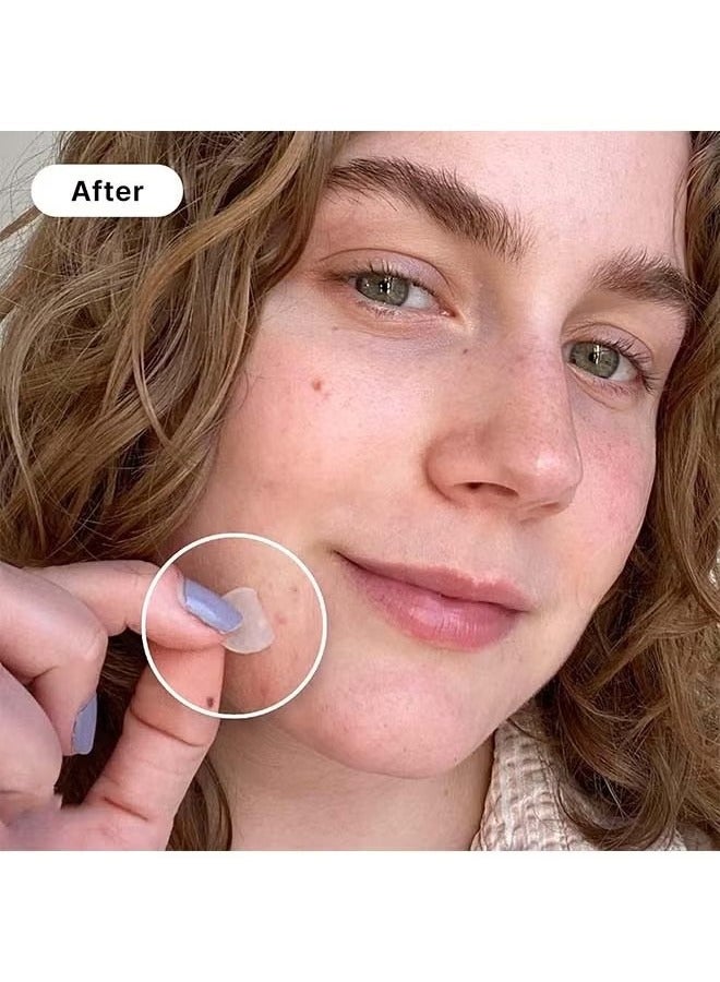 ATRJSZ 120 Count Pimple Patch, Acne Pimple Patch Absorbing Hydrocolloid Original 3 Size Patches for Blemishes and Zits Cover, Spot Stickers for Face and Body (120 Count (Pack of 5)) - Image 4