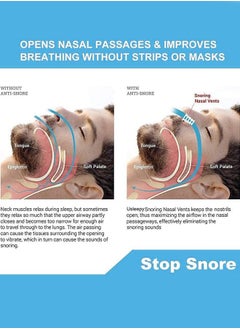 Generic 8 Pieces Anti Snoring Devices, Nasal Dilator snoring nose vents Stopper for Travel and Home  - Image 4