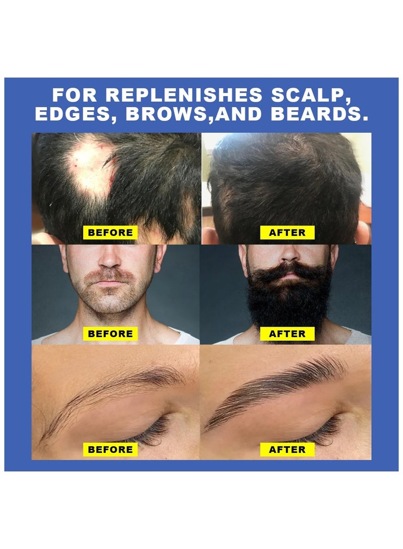 Vera Super Hair Growth Kit Minoxidil 5% with Biotin 60ml - Image 4