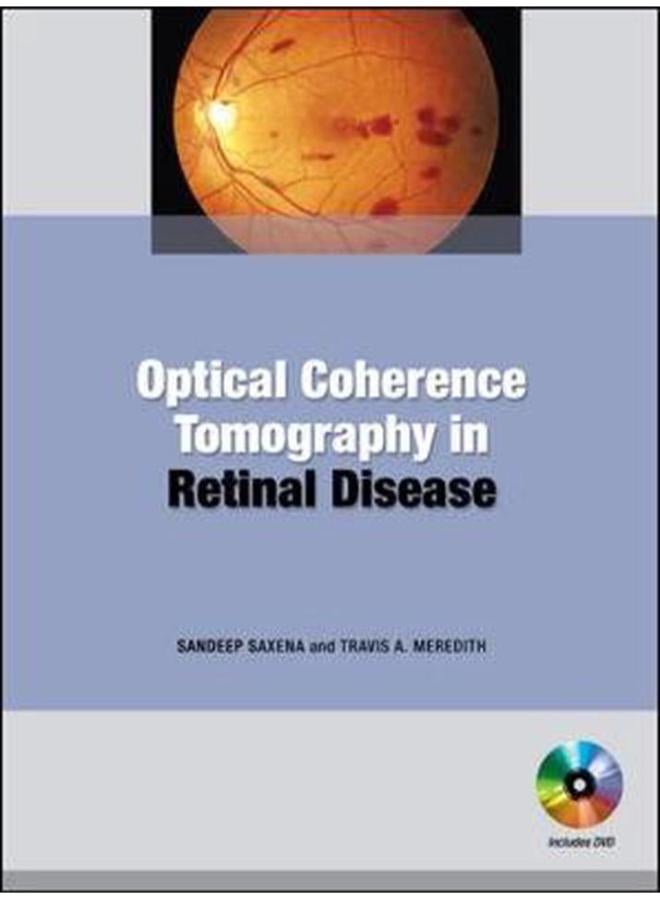 Optical Coherence Tomography in Retinal Disease