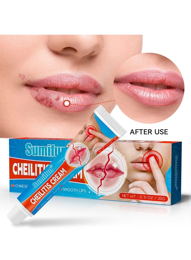 سوميفون التهاب الشفة كريم الصينية الأدوية العشبية الشفاه الناعمة، وإصلاح الشفاه المتشققة والجافة | مكونات طبيعية للتبريد الفوري وتخفيف الآلام | إزالة الجلد الميت / تلاشي خطوط الشفاه / تحسين لون الشفاه ... - Image 1