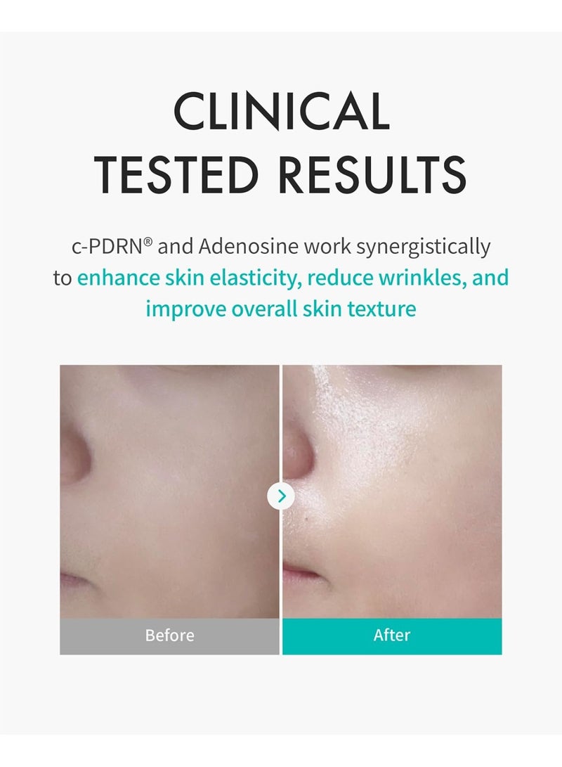 REJURAN TURNOVER MASK 40ML (PACK OF 5) - Image 3