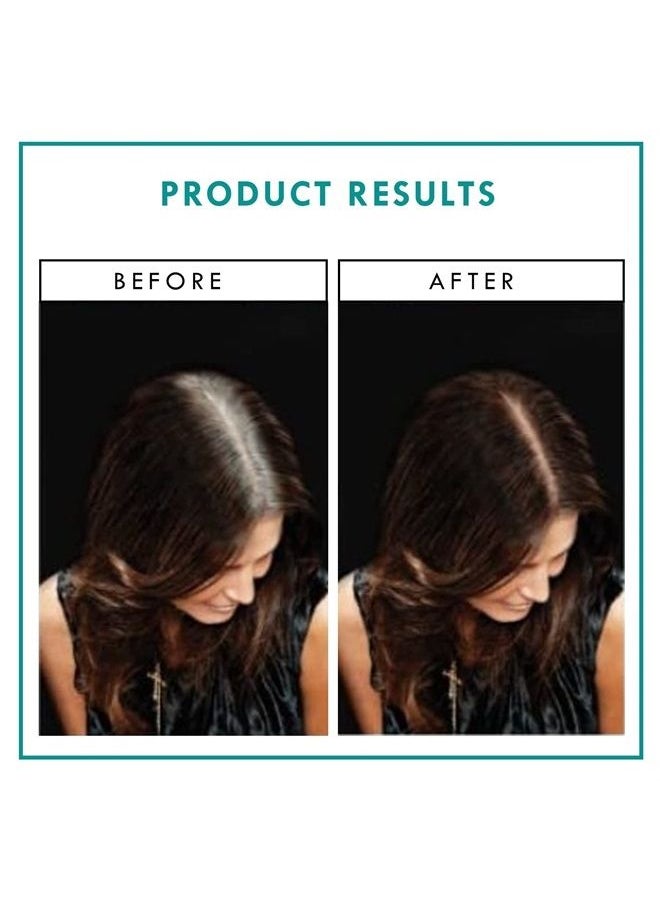 Rita Hazan - Rita Hazan Root Concealer Touch Up Spray - Instant Spray To Cover Up Roots - Quick Drying, Water-Resistant Formula - Temporary Hair Color Spray for Gray Roots - 2 oz. Root Spray - Image 1