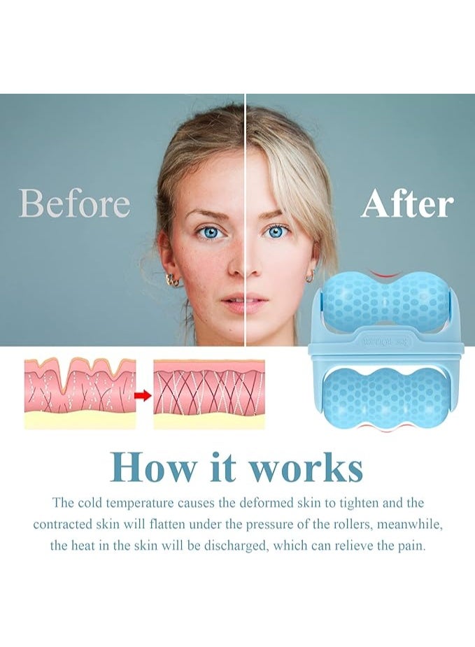 Ice Roller for Eyes and Puffiness, 2 in 1 Body Roller for Pain Relief, Minor Injuries, Facial Massager and Muscle Toning - 253 - Image 4
