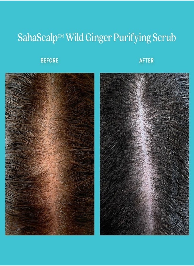 Fable and Mane Fable and Mane SahaScalp™ - Scalp Reset Kit  - Image 5