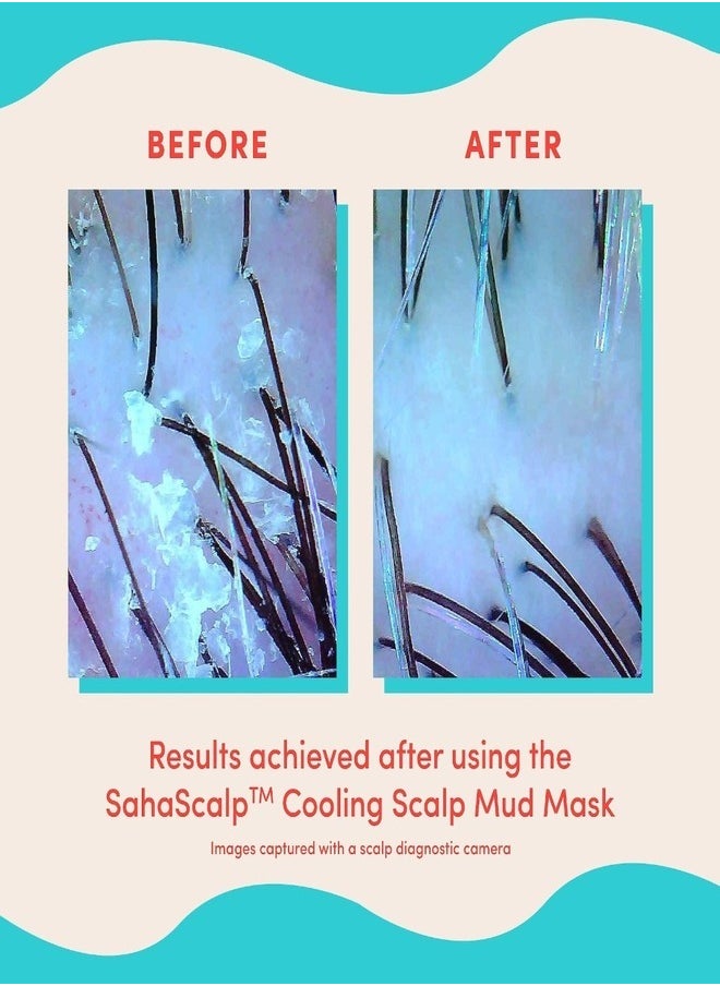Fable and Mane - Fable and Mane SahaScalp™ - Scalp Reset Kit - Image 1
