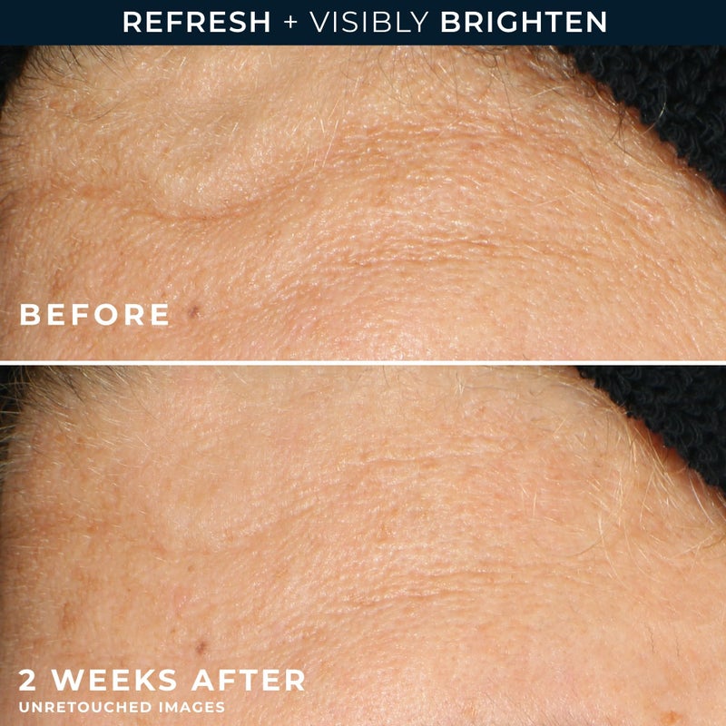 RoC Multi Correxion Revive + Glow Gel Vitamin C Cleanser, Face Wash, Facial Cleanser with Glycolic Acid, Paraben-Free, Sulfate-Free Skin Care - 6 Ounces - Image 5