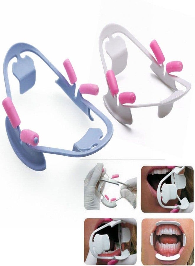 SeeFDENT 2 PCS Dental 3D Oral Intraoral Cheek Lip Retractor Orthodontic Mouth Prop Opener Size S L - Image 1