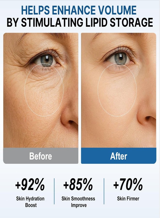 OLELON Volufiline Serum, 100% French Volufiline Skin Ampoule, 15ml x 2 - Image 3
