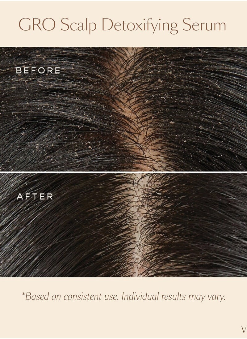 VEGAMOUR - VEGAMOUR GRO Scalp Detoxifying & Clarifying Treatment for Dry, Flaky, Oily Scalp, 60ml – Deep Cleansing, Balancing, and Hydrating Formula with Plant-Based Ingredients - Image 1