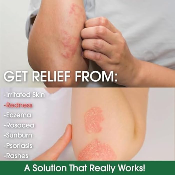 Green Leaf Naturals - Manuka Honey Face Cream - 4oz -Aloe Vera - Jojoba Oil Infused - Body Cream - Gluten Free Moisturizer for Kids & Adults - Nourishing Skin Care - Image 4