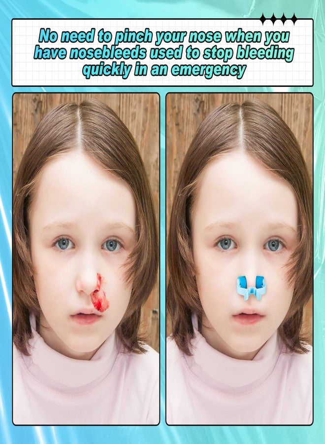 Fabbay 50 Pcs Stop Nosebleeds Clip Nose Bleed Stopper Nasal Clip for Adult Emergency Accident, Blue and Green - Image 4