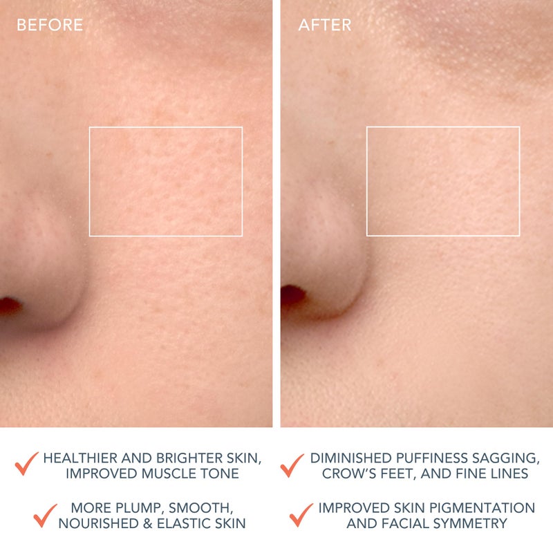 FOREO LUNA 4 Face Cleansing Brush - Anti Aging - Enhances Absorption of Facial Skin Care Products - Simple Skin Care Tools - Balanced Skin - Image 5