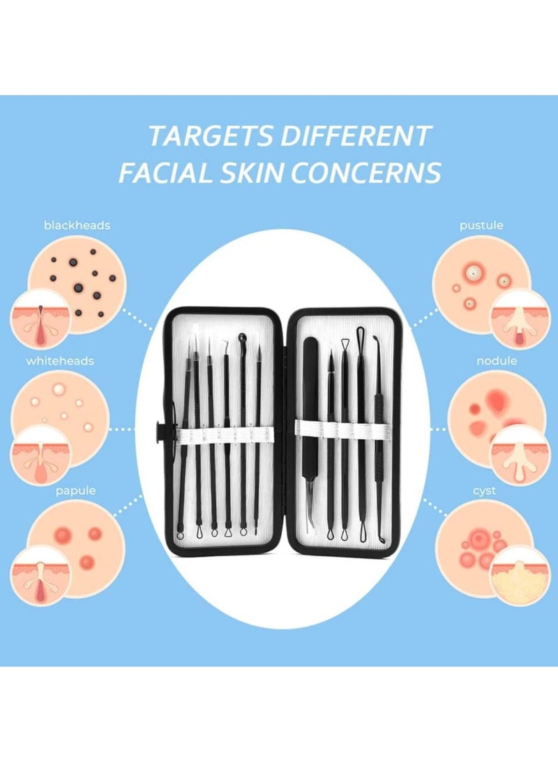 SYOSI - Pimple Popper Tool Kit, 10 Pcs Blackhead Remover Zit Popper for Blemish, Teenitor Blackhead Extractor and Pimple Tool Safe Treatment Zit Popper Acne Kit Black Head Extractions Tool Comedone Extractor - Image 1