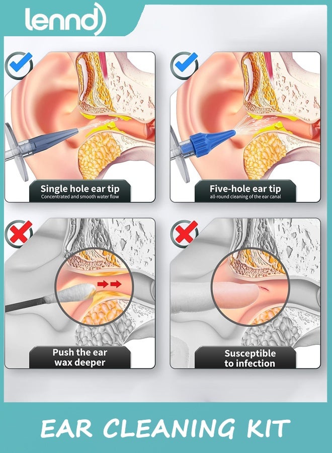 لينند إزالة شمع الأذن، منظف الأذن، مجموعة تنظيف الأذن، نظام غسيل الأذن اليدوي، مجموعة إزالة شمع الأذن، آمنة وفعالة لتنظيف شمع الأذن المتراكم - Image 4