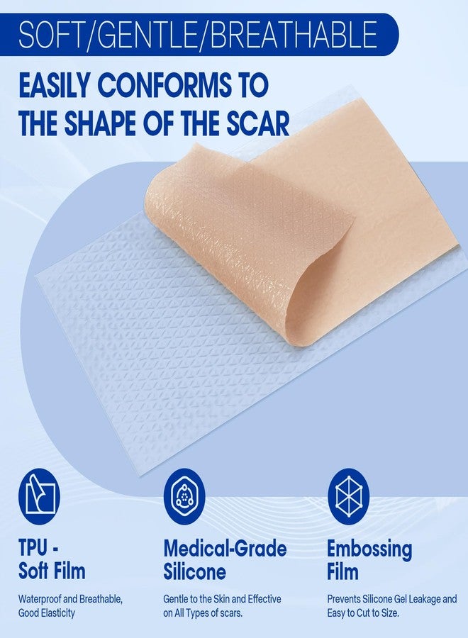 ALLGLAM Medical Silicone Scar Tape, 1.6″ x 60″ Roll - Image 4