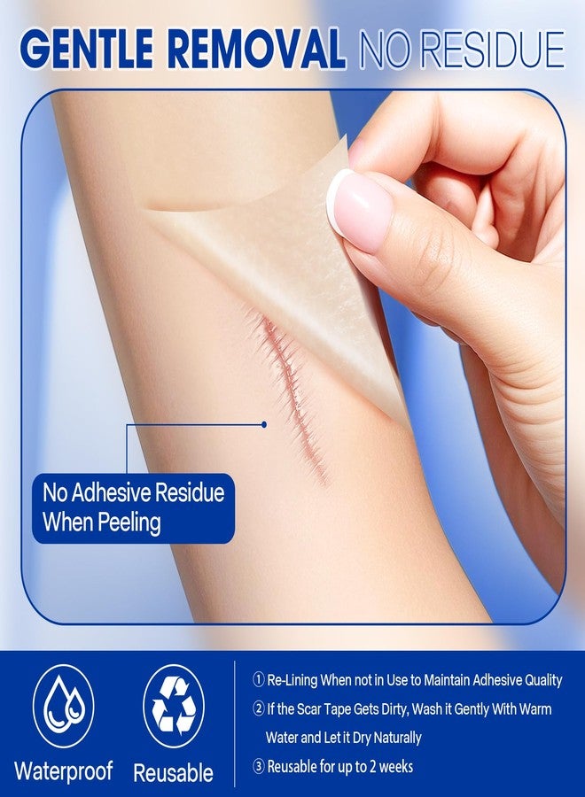 ALLGLAM Medical Silicone Scar Tape, 1.6″ x 60″ Roll - Image 5