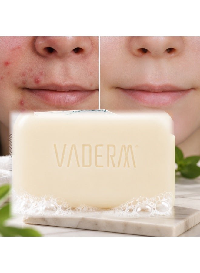 VADERM Red Algae Antibacterial & Whitening Soap – Acne Care & Deep Cleansing Bar 60g - Image 2