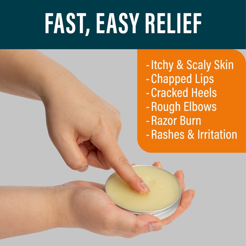 NUVADERMIS Tea Tree Oil Foot Balm â€“ Effective Recovery Balm for Dry, Cracked Feet, Athleteâ€™s Foot, Ringworm & Itchy Skin â€“ Soothing Moisturizer â€“ 2 oz - Image 3