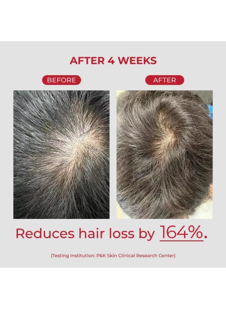 MOEV Hair Loss & Weak Hair Solution – MOEV Annurcatin Shampoo 525ml for Strengthening, Regrowth Support & Anti-Breakage Care - Image 4